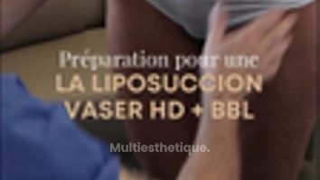 Liposuccion - Dr Maxime Cowen