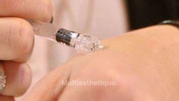 L'acide hyaluronique