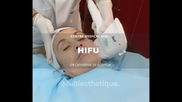 HIFU - Dr Catherine de Goursac