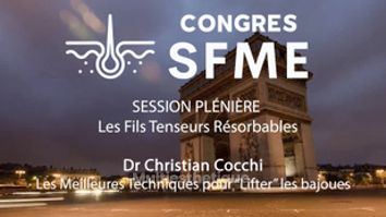 Fils tenseurs - Dr Christian Cocchi