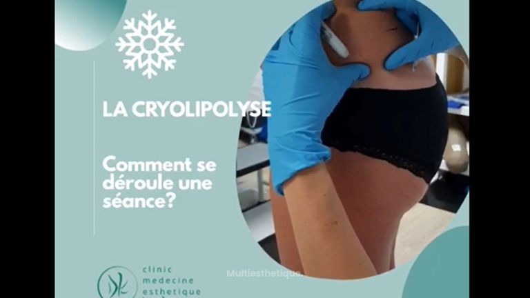 Cryolipolyse - Dr Marie Levisse - méDiKal esthétique