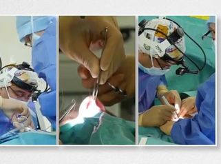 Rhinoplastie par le docteur Tourniaire