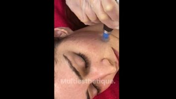Skinbooster - Dr Mahboubeh Charlot