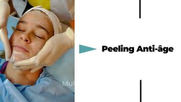 Peeling - Dr Catherine de Goursac