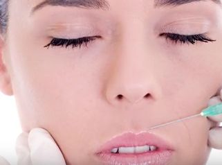 Acide hyaluronique et Botox : des techniques complémentaires ? 