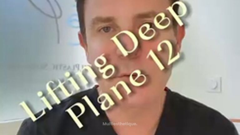 Lifting Deep Plane Pr Jean-Paul Meningaud