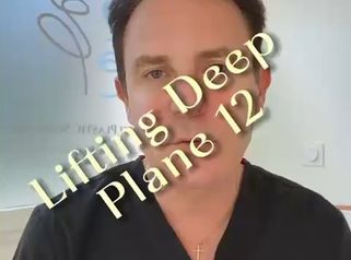 Lifting Deep Plane Pr Jean-Paul Meningaud