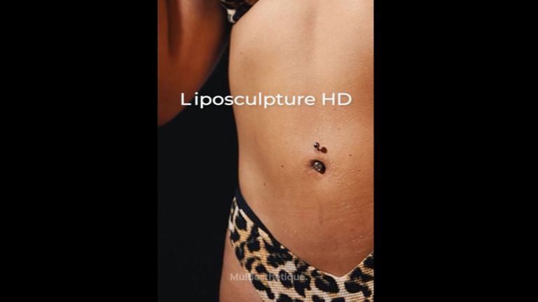 Liposuccion - Dr Alexis Delobaux