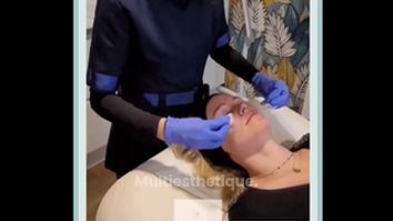 Peeling - Dr Marie Levisse - méDiKal esthétique