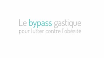 Le bypass gastrique pour lutter contre l'obésité.