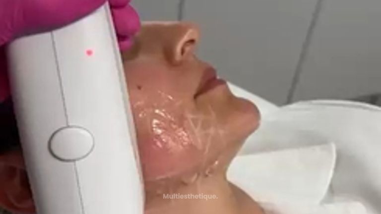 Taches pigmentaires - Dr Inna Gridina