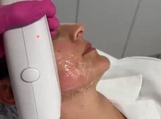 Taches pigmentaires - Dr Inna Gridina