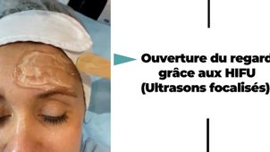 Vidéo explicative du Dr Catherine de Goursac